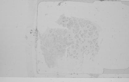 A method and system for identifying and organizing foreground segmentation of IHC digital preview images