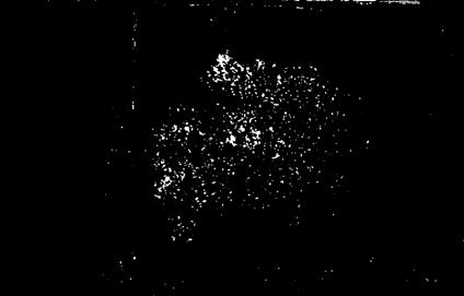 A method and system for identifying and organizing foreground segmentation of IHC digital preview images