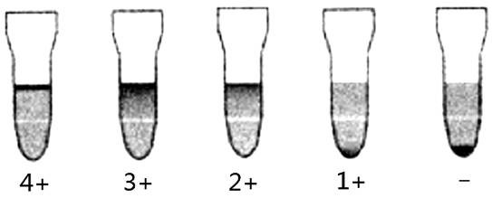 Antibody diluent for Rh system typing detection card and detection card