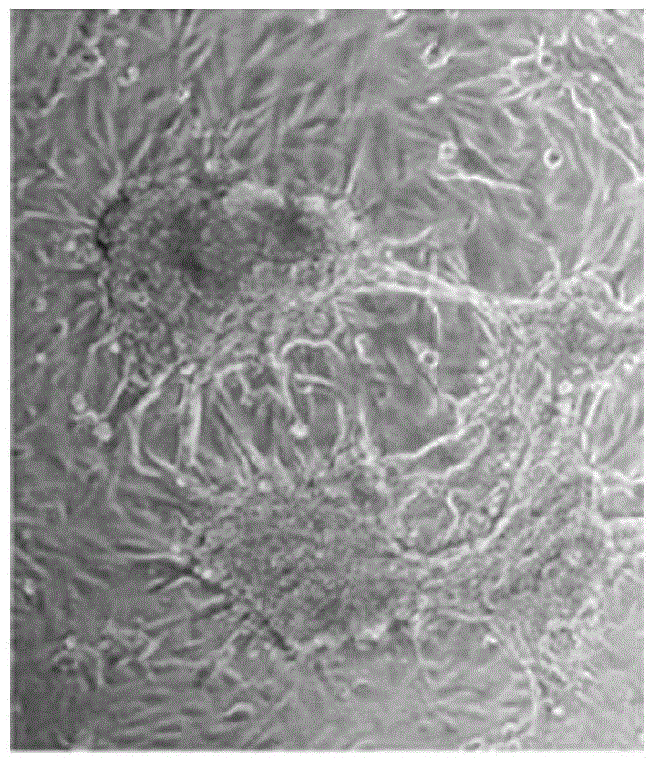 Recombinant pasteurella multocida toxin protein and application thereof