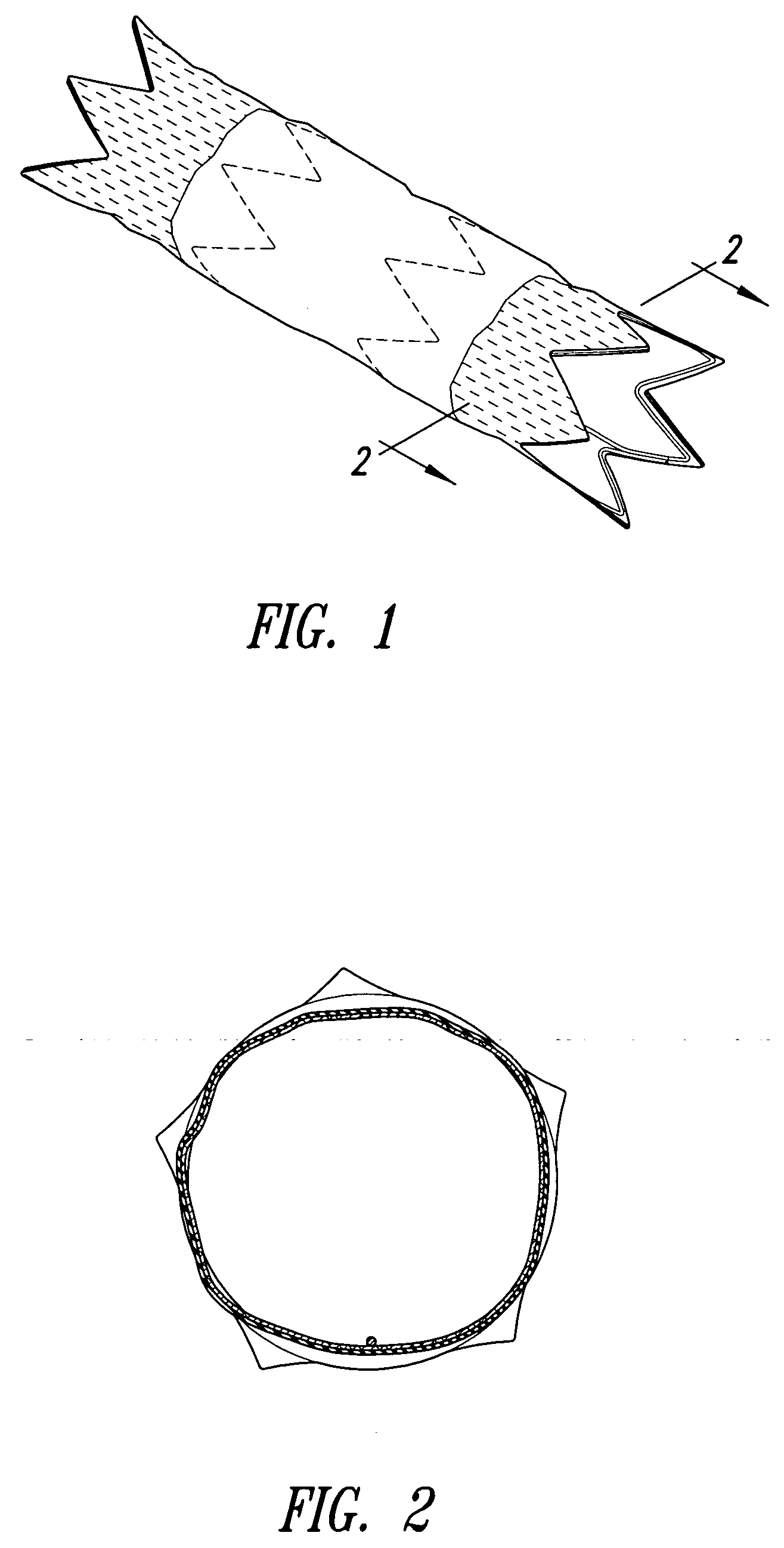 Stent grafts with bioactive coatings