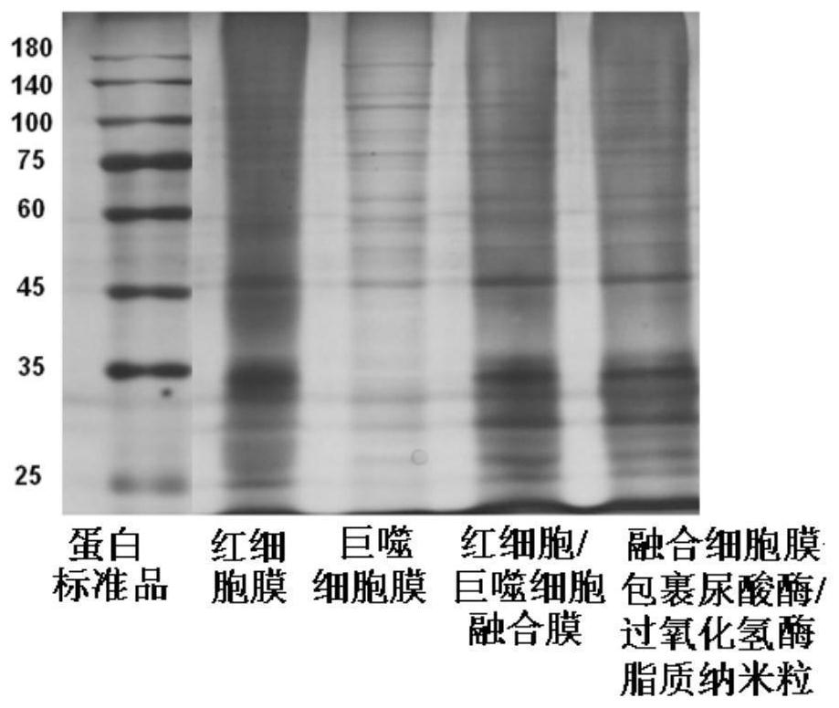 Uricase/catalase lipid nanoparticles wrapped by fusion cell membrane and preparation method of uricase/catalase lipid nanoparticles