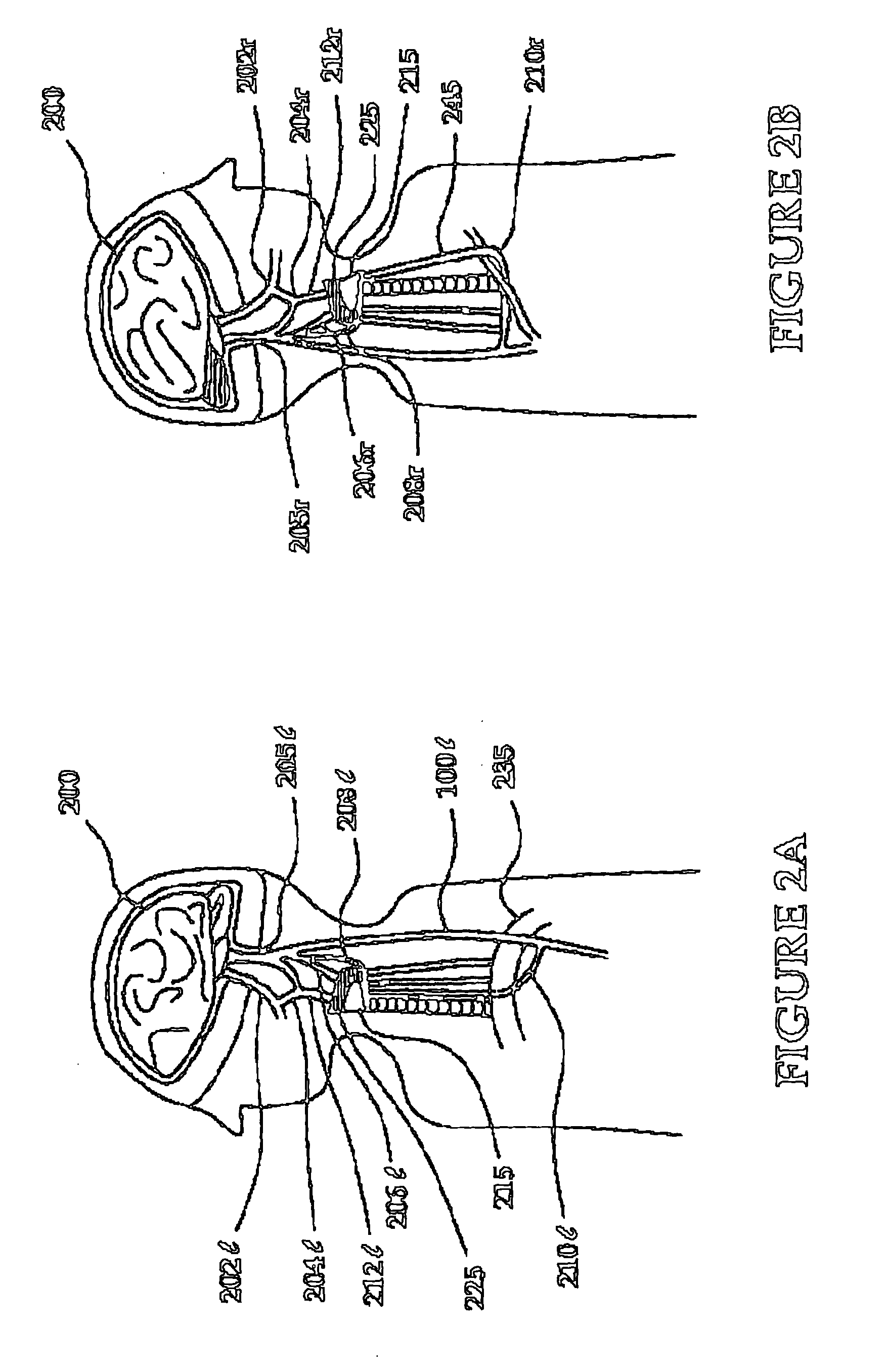 Cranial nerve stimulation to treat a vocal cord disorder