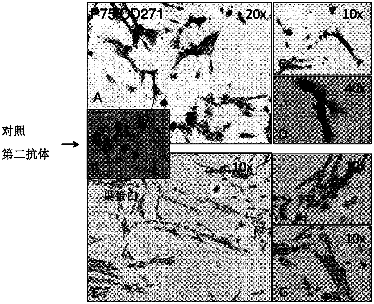 Stem cells expressing mesenchymal and neuronal markers, compositions thereof, and methods of preparation thereof