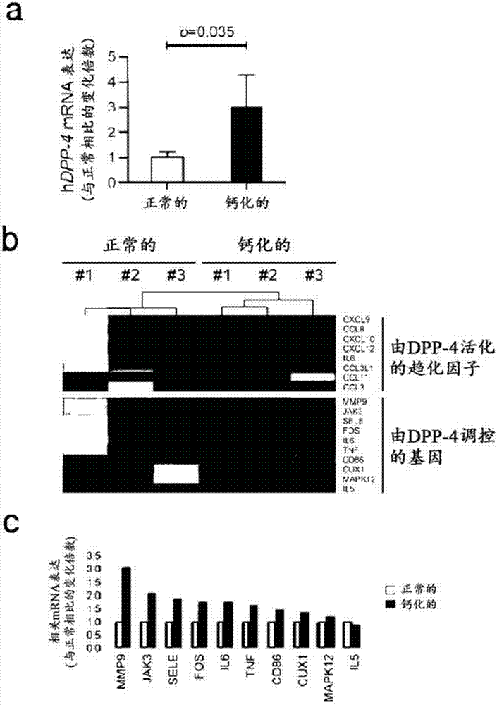 Composition for preventing or treating valve calcification, containing dpp-4 inhibitor