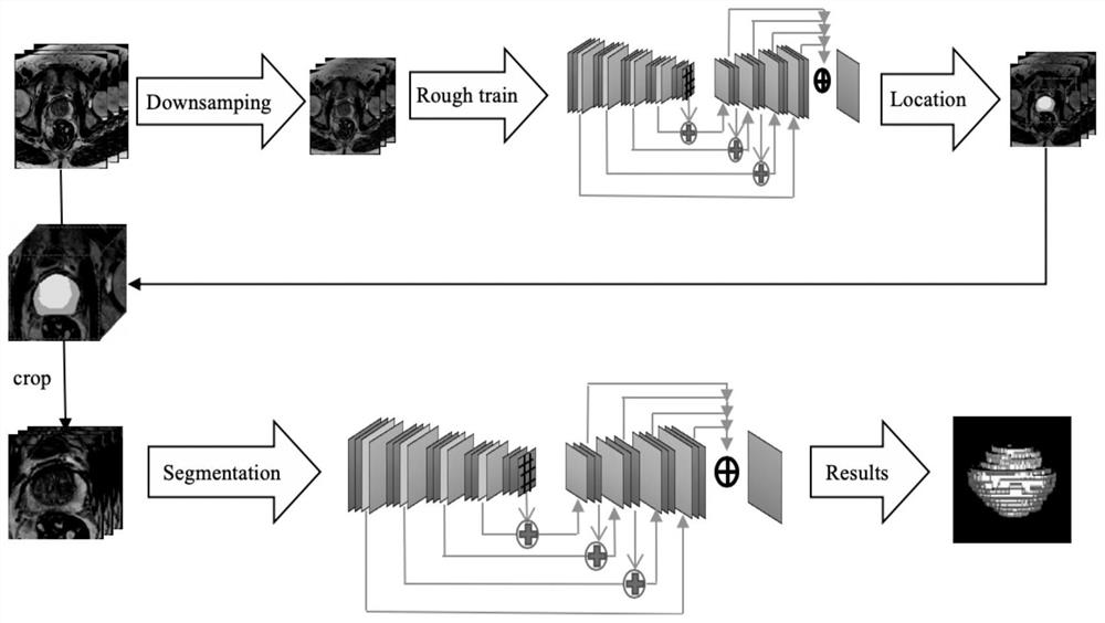 Medical image segmentation method based on 3D dynamic edge insensitivity loss function