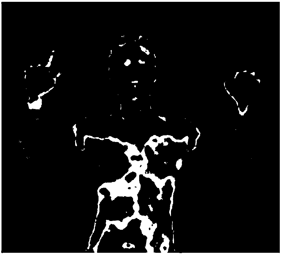 Human body infrared thermal image processing method and system