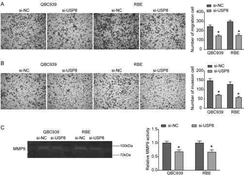 A detection, treatment and prognosis target and application of cholangiocarcinoma