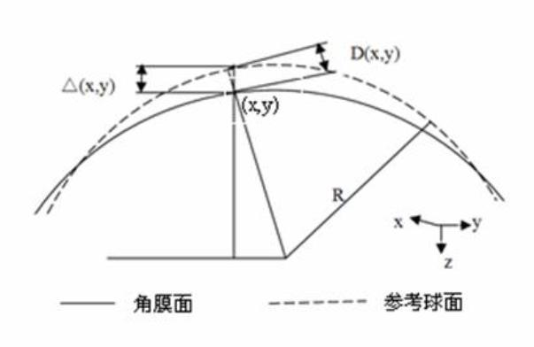 Design method for cornea contact lens based on wave front technology