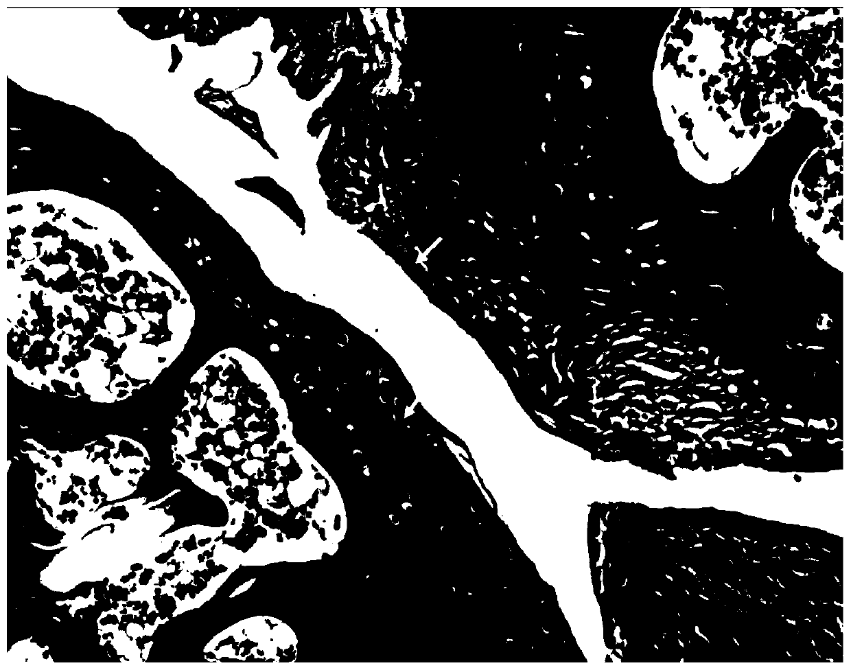 Purpose of neuronal guidance factor semaphorin 3a for preparing medicine capable of treating osteoarthritis