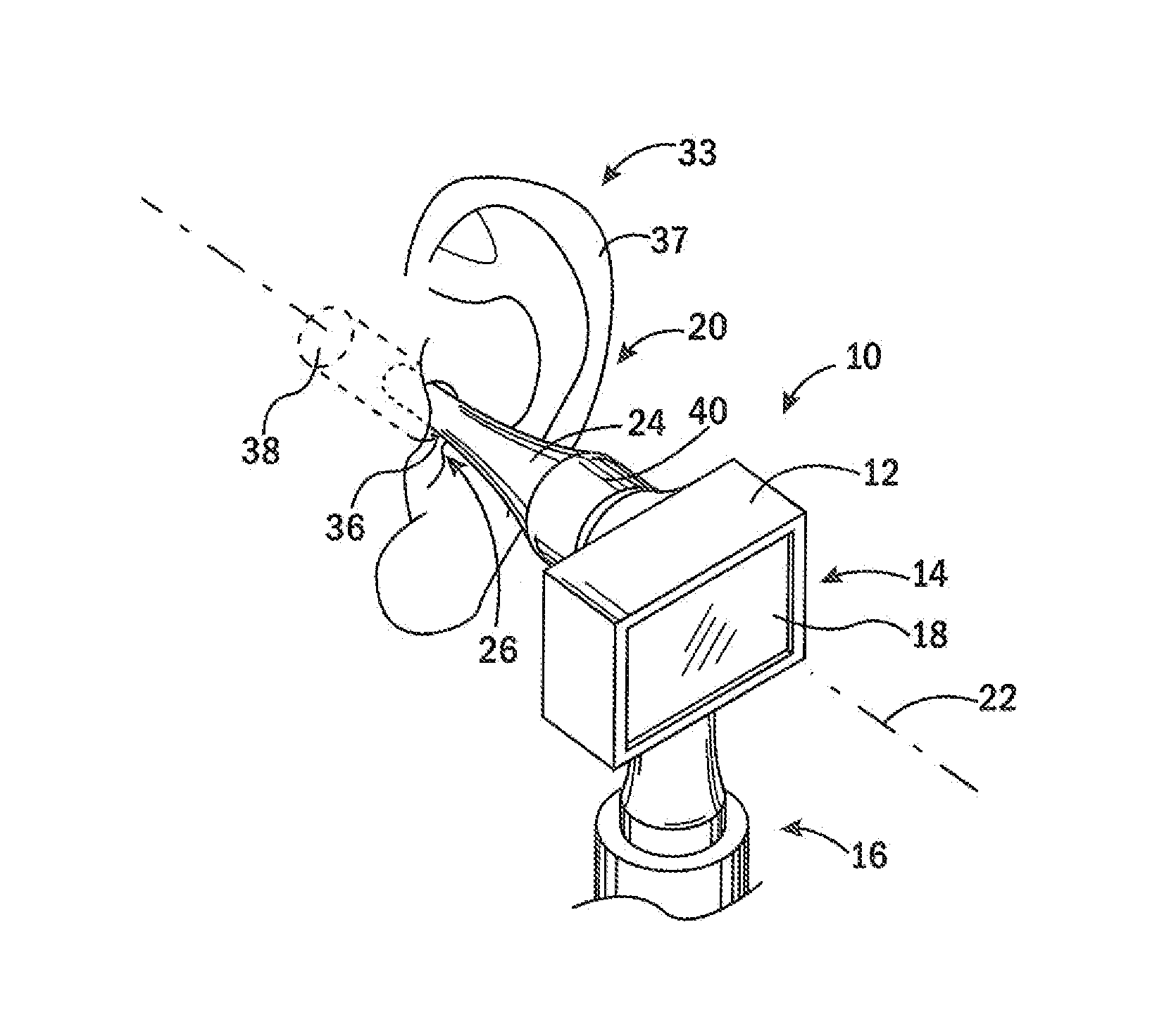 Otoscope Providing Multi-Directional Illumination