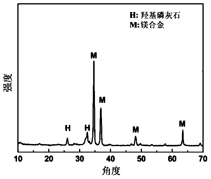 Double-layer whisker-like fluorine-doped hydroxyapatite coating on magnesium alloy and its microwave preparation method