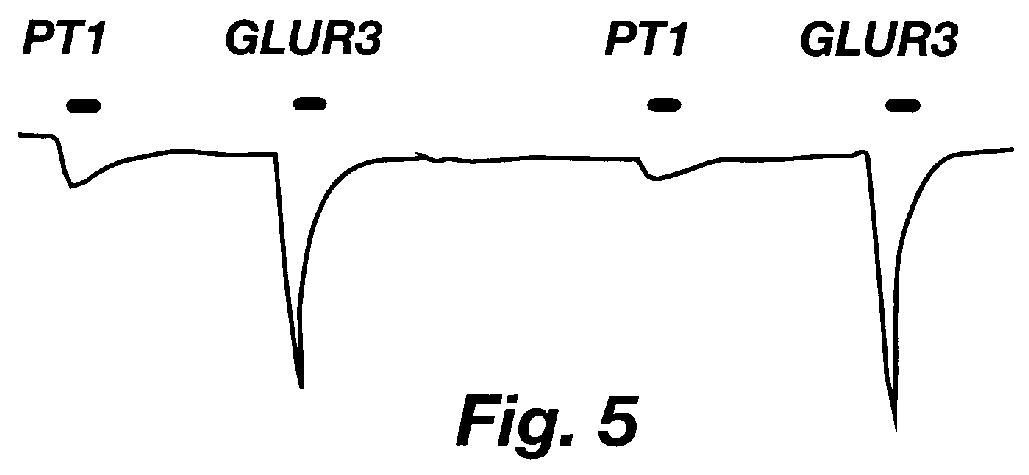 Autoantibodies to neurotransmitter receptors