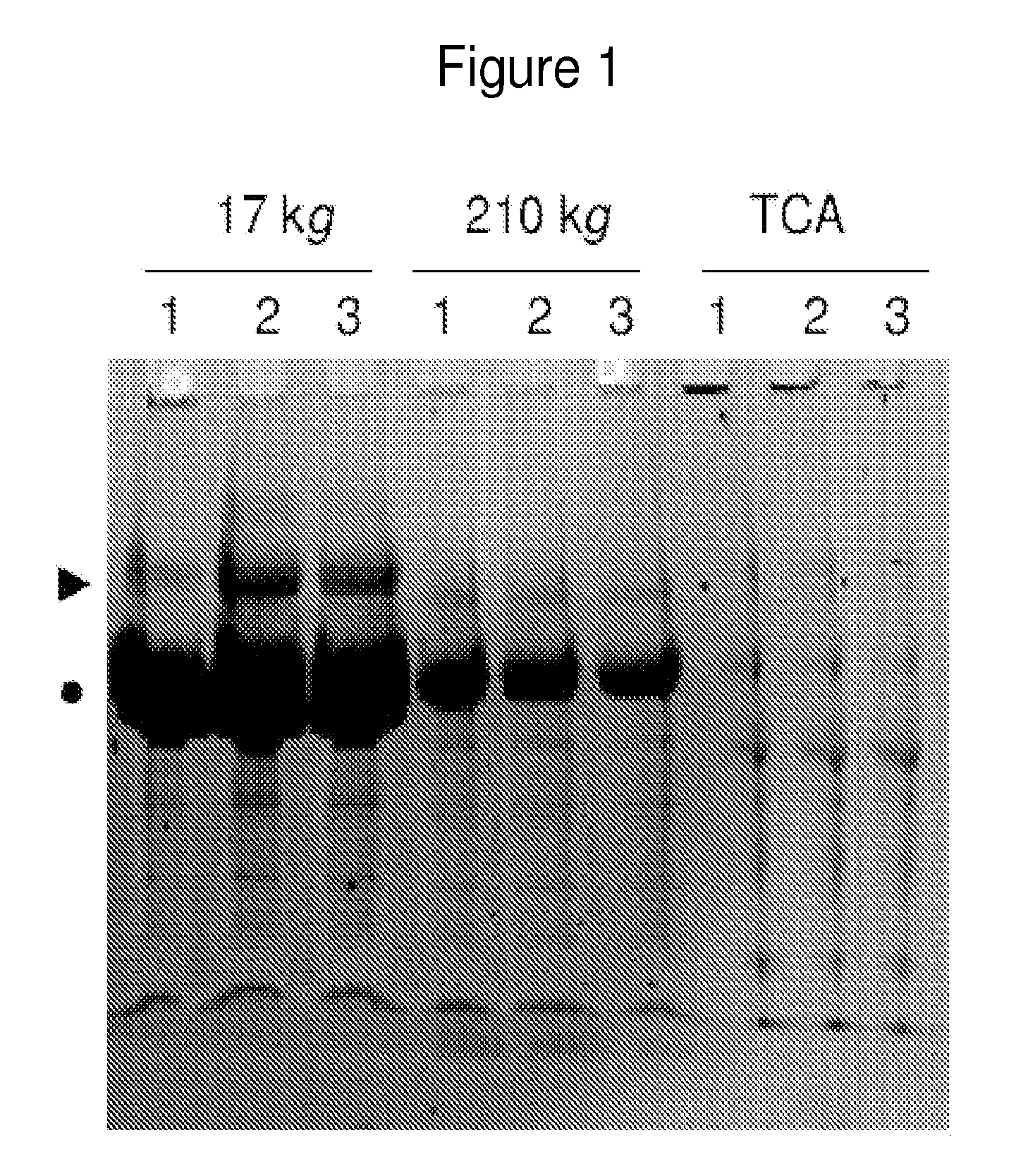 Method of predicting acute appendicitis