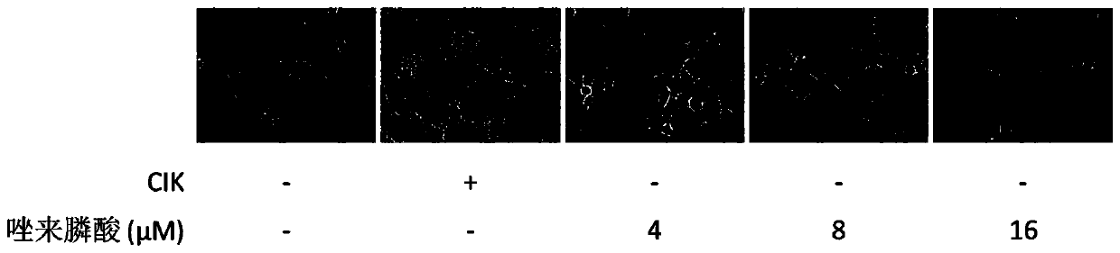 An anti-tumor combination drug