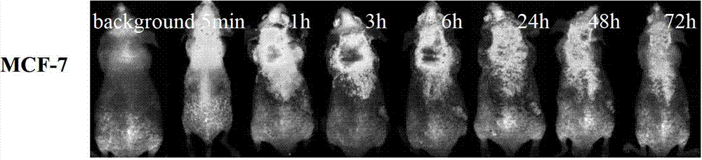 Fluorescence contrast agent and preparation method thereof