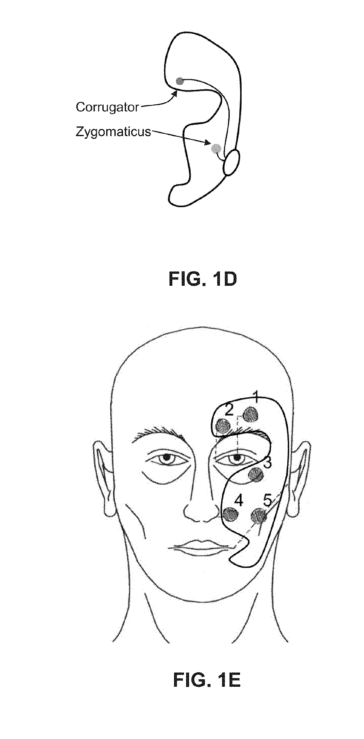 Pain assessment method and apparatus for patients unable to self-report pain