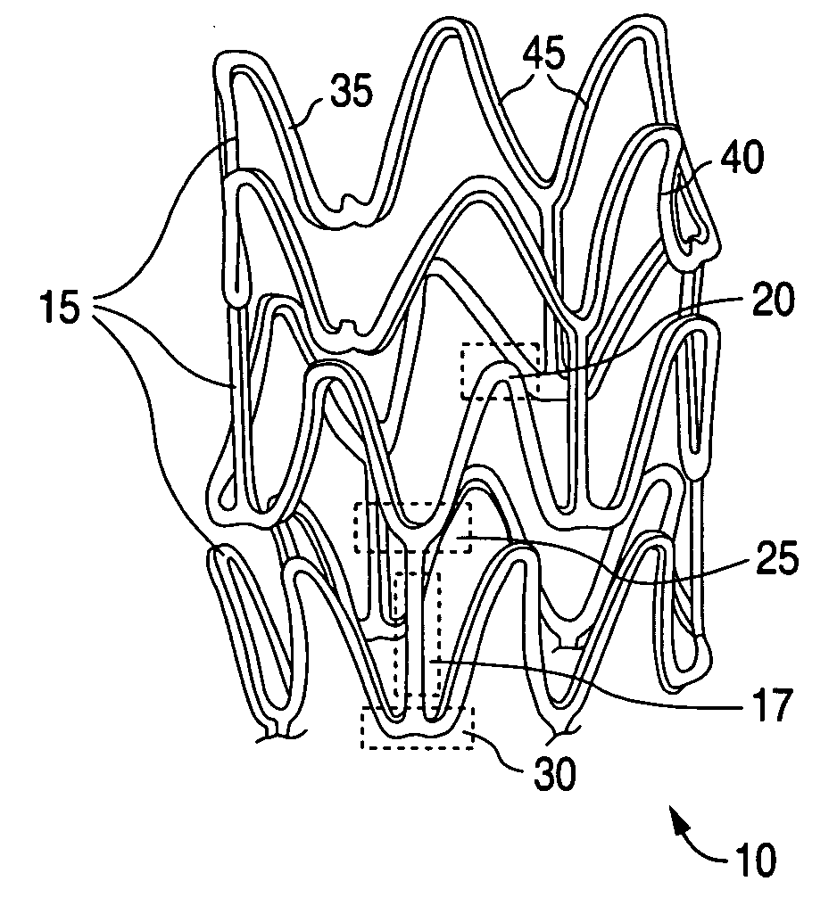 Stent with flexible sections in high strain regions