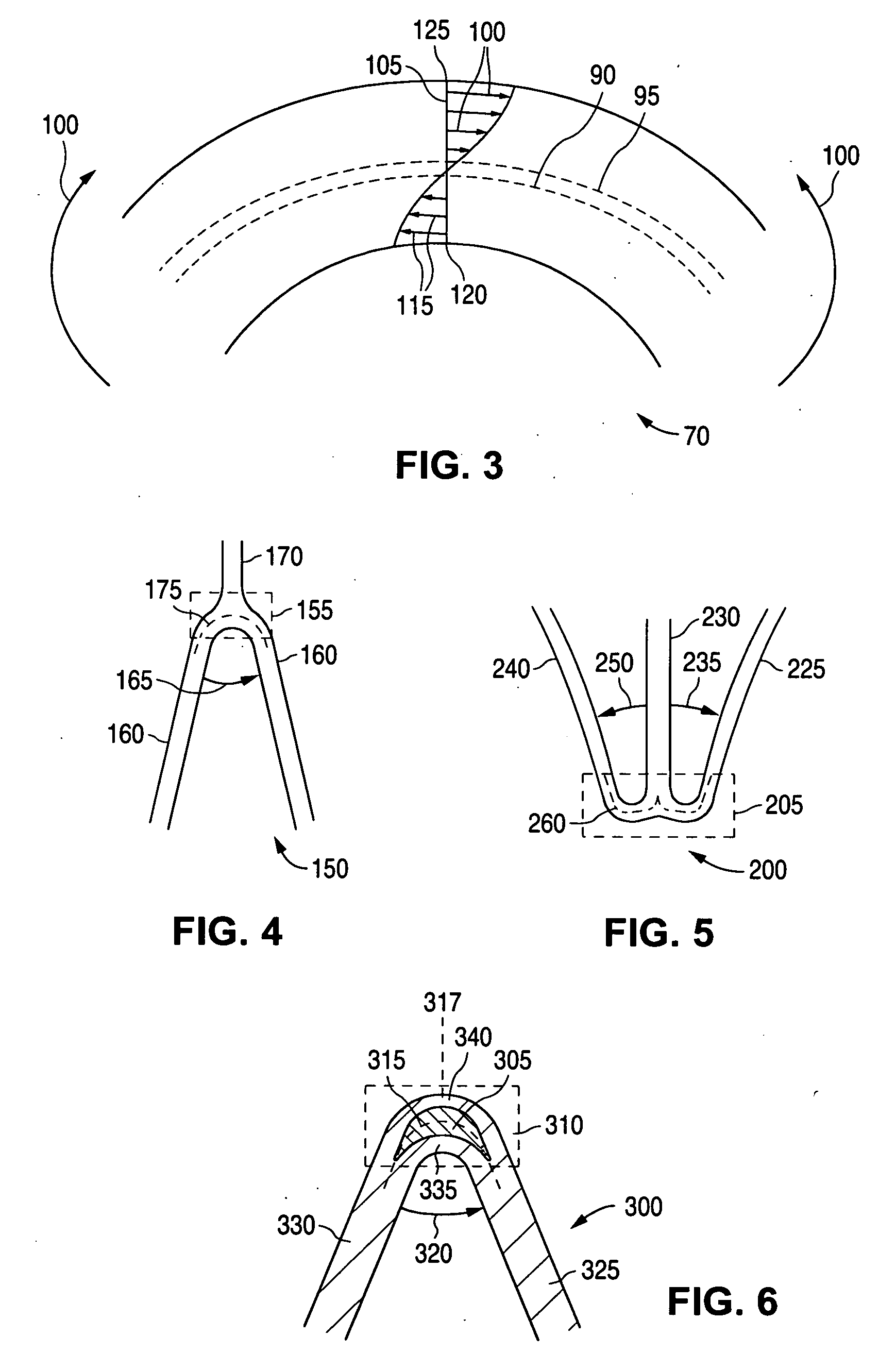 Stent with flexible sections in high strain regions