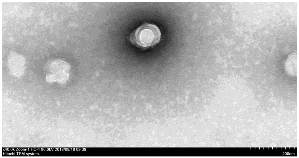 Application and preparation kit of a kind of exosome microRNA