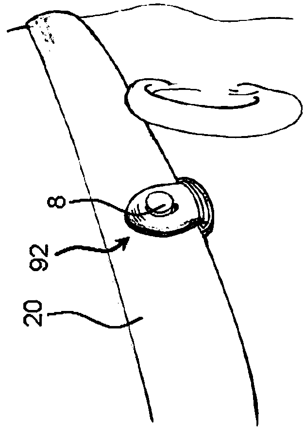 Mounting assembly for a bone conduction hearing device