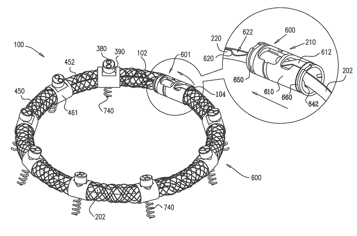 Implantation of repair devices in the heart