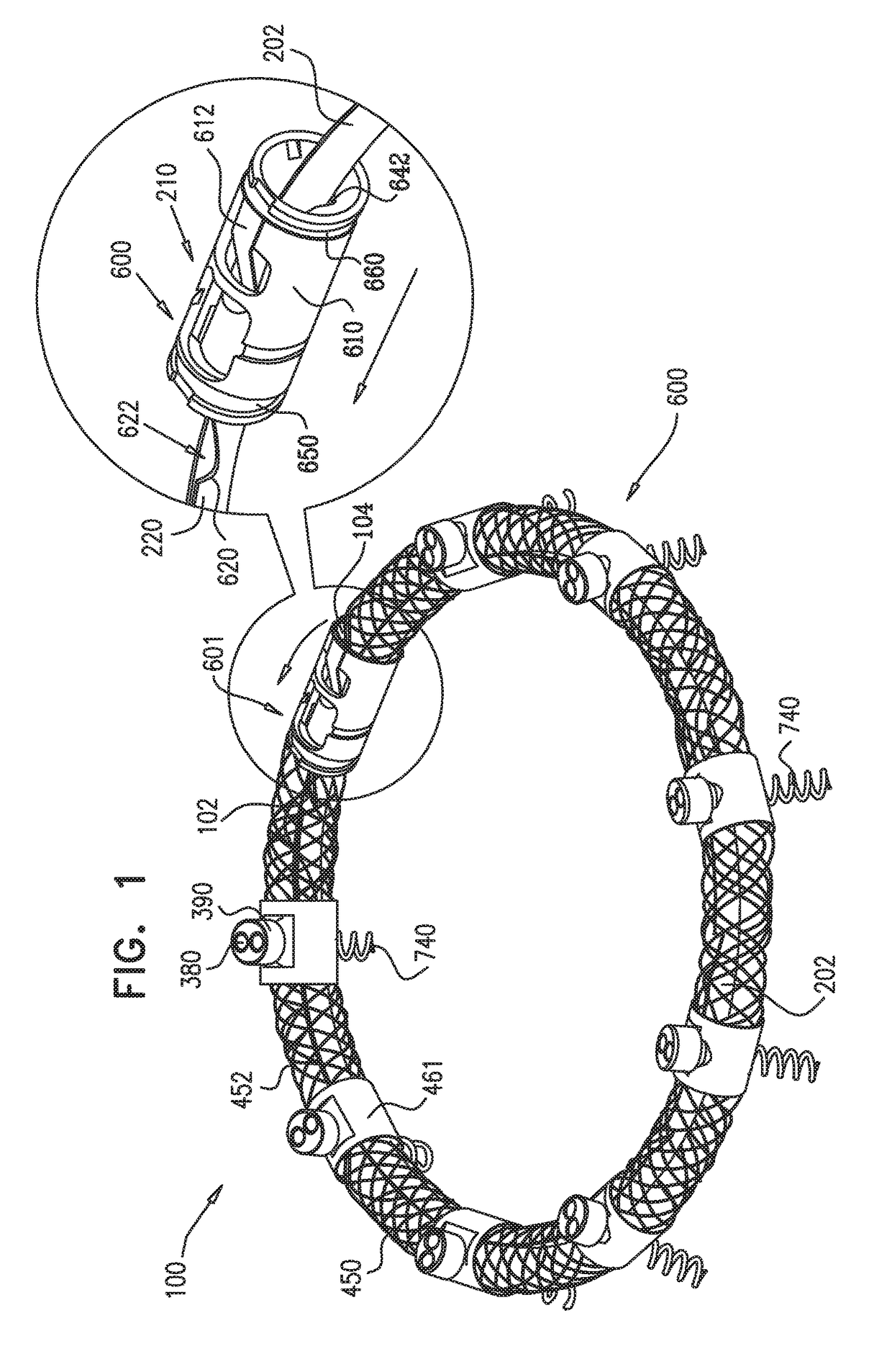 Implantation of repair devices in the heart