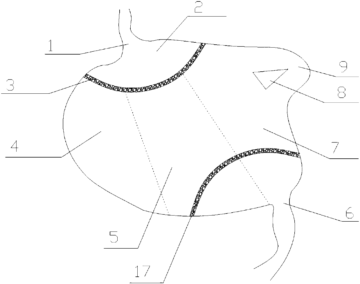 Diversion and purification system for an artificial lake water body and construction method thereof