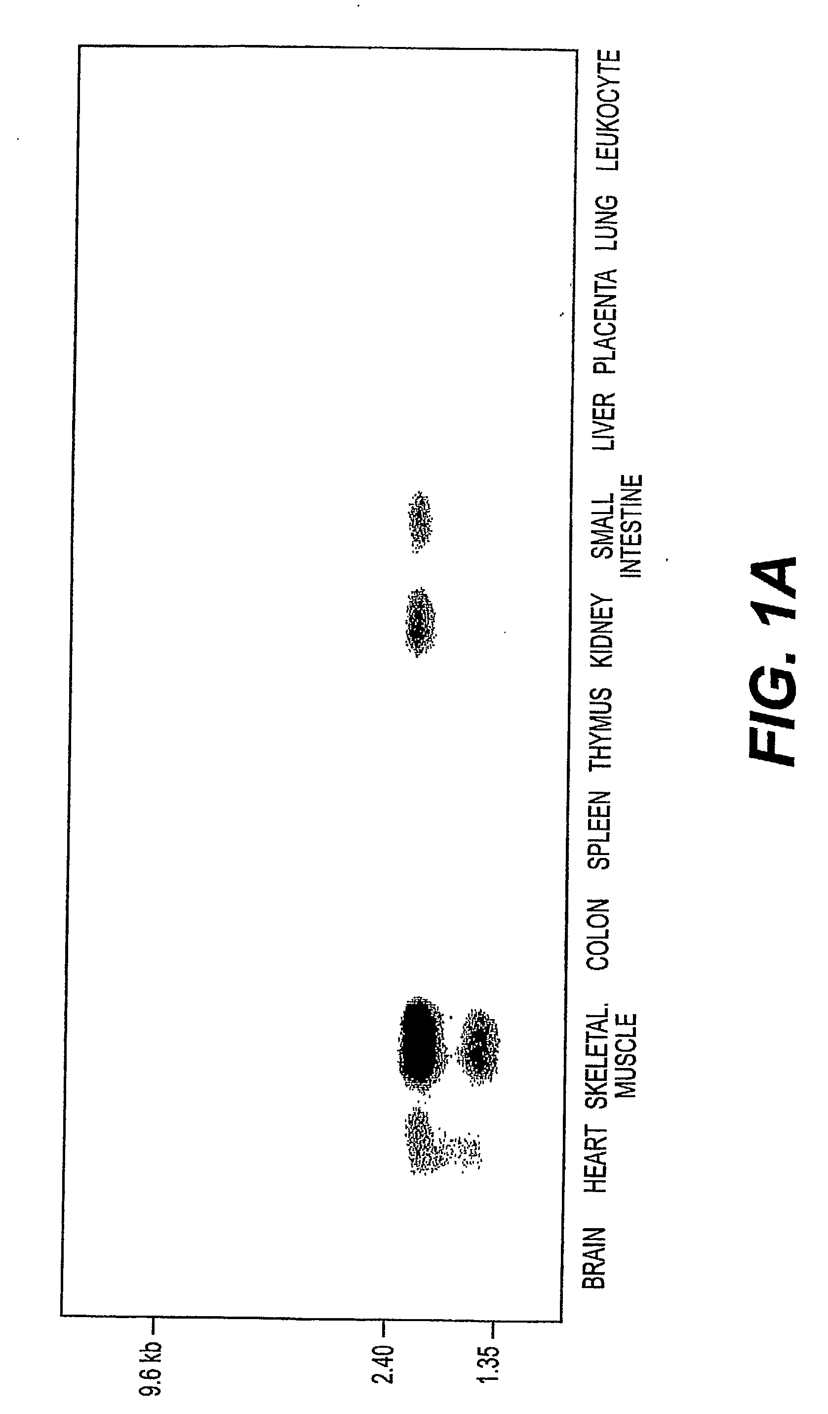 Detection, Isolation and Uses Of Renalase (Monoamine Oxidase C)