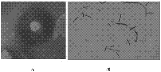 A kind of pullulanase enzyme-producing strain and the method for improving its enzyme-producing ability