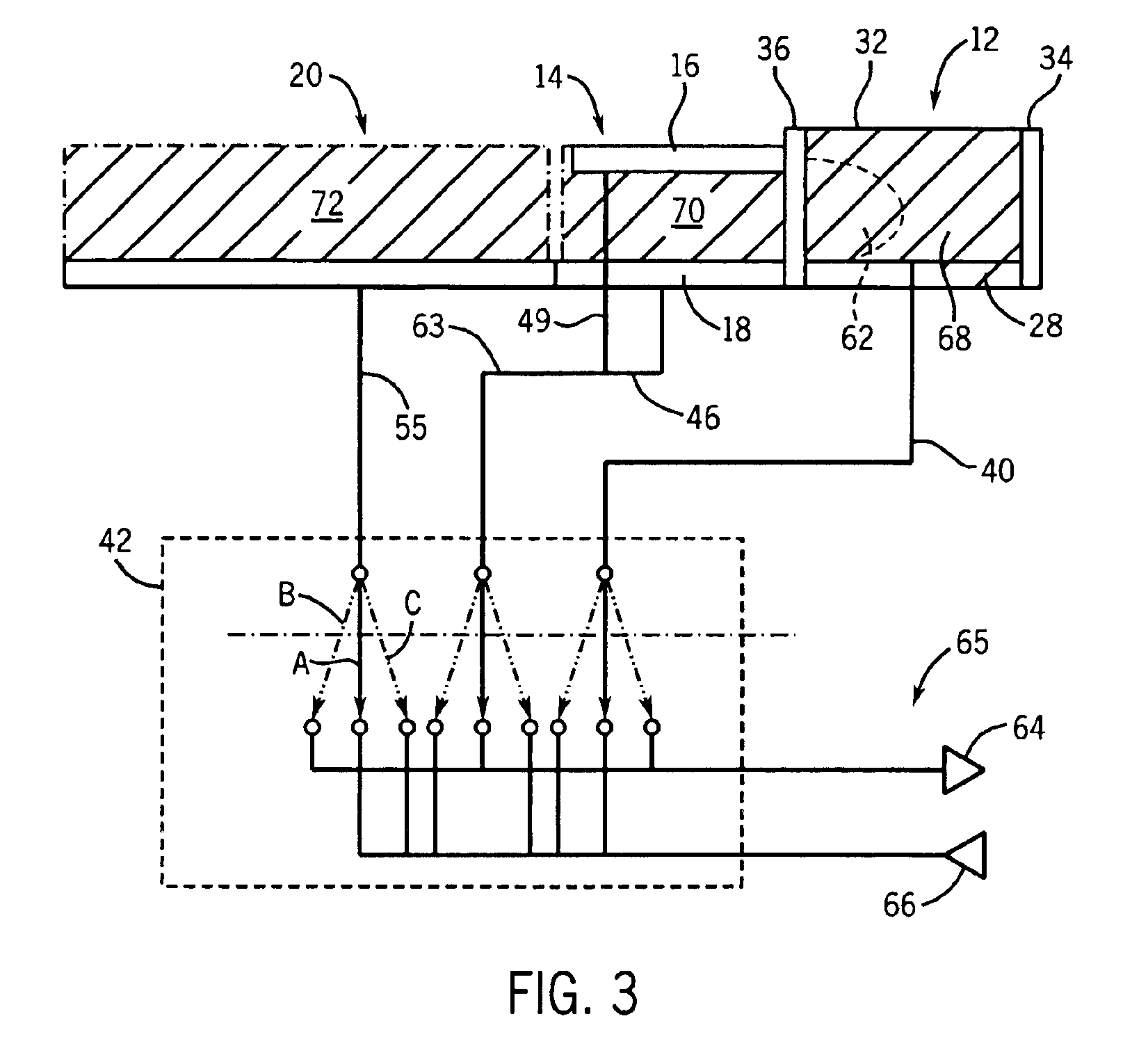 Modular local coil set for magnetic resonance imaging