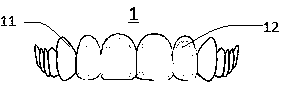 Invisible brace with beautification layer