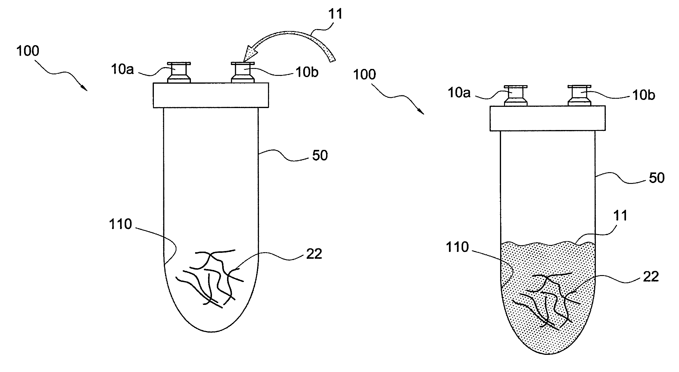 Enhanced autologous growth factor production and delivery system