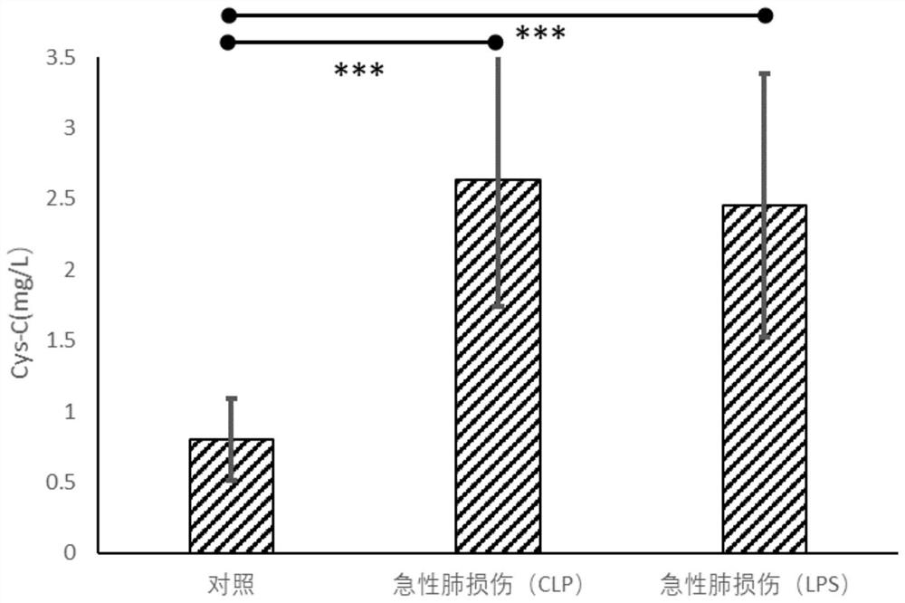 Application of Apelin protein in preparation of reagent for diagnosing respiratory system diseases