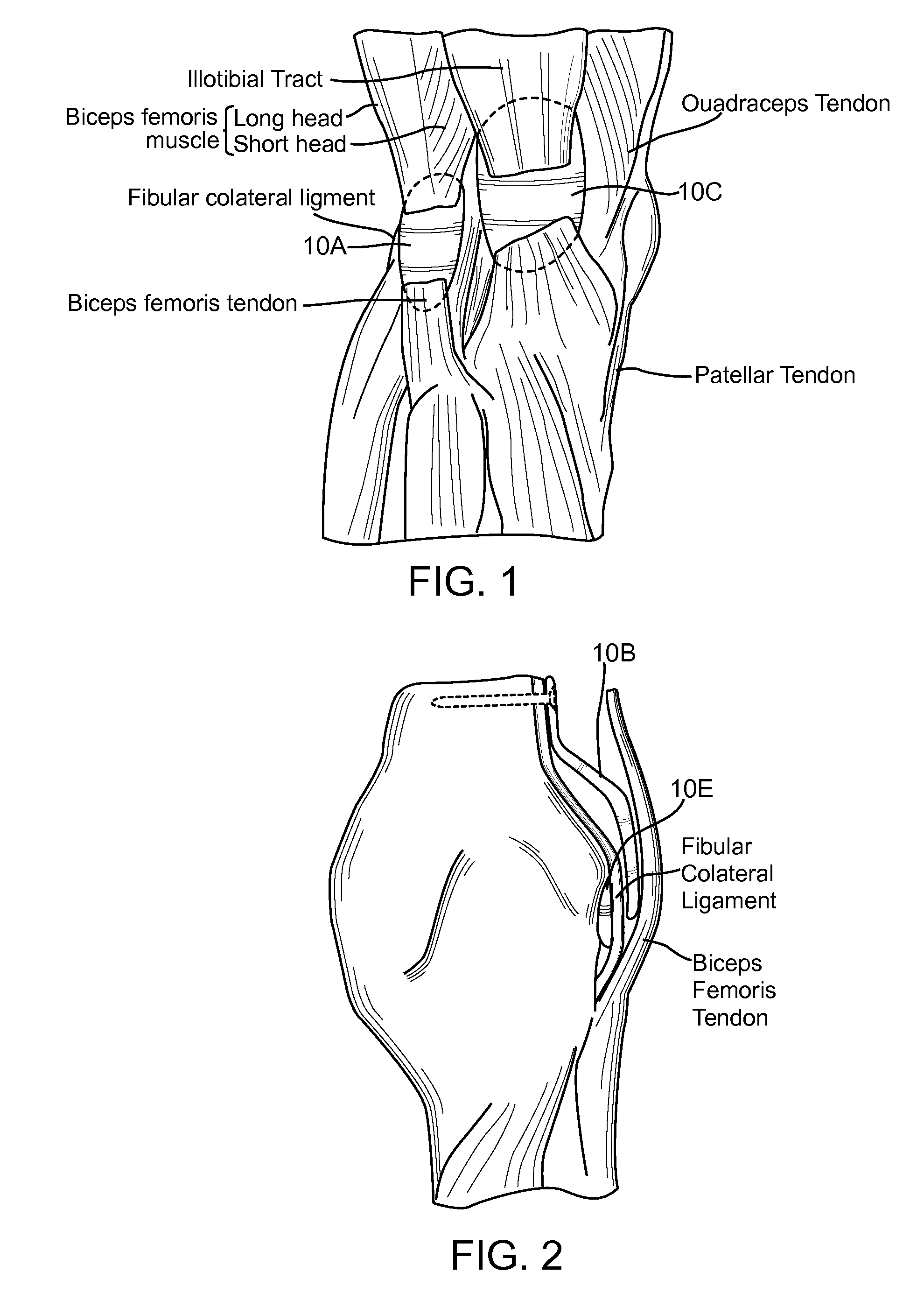 Method and Apparatus for Force Redistribution in Articular Joints