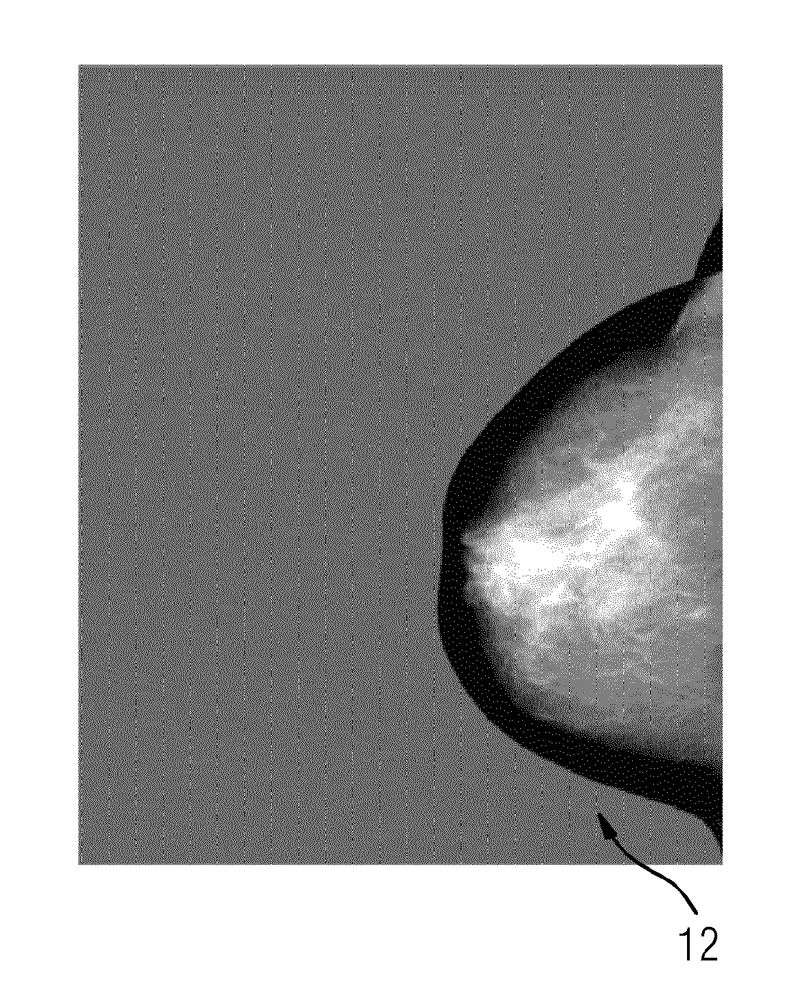 Evaluation of an x-ray image of a breast produced during a mammography