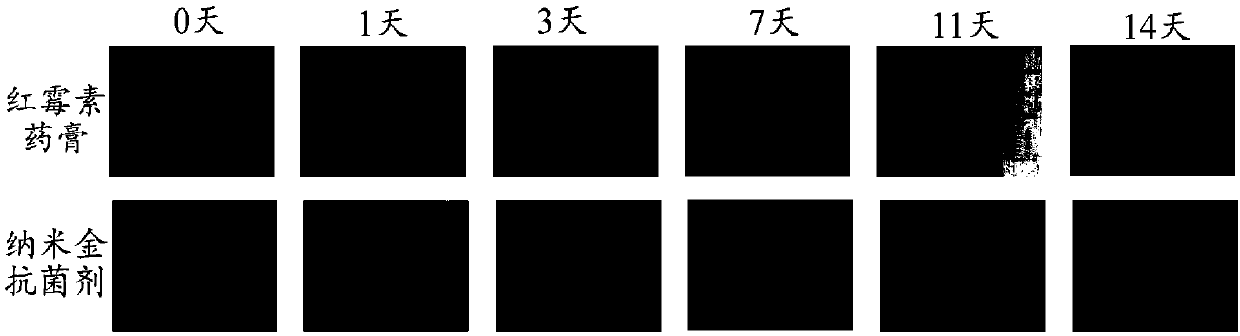 Preparation method of nanogold-containing antibacterial agent