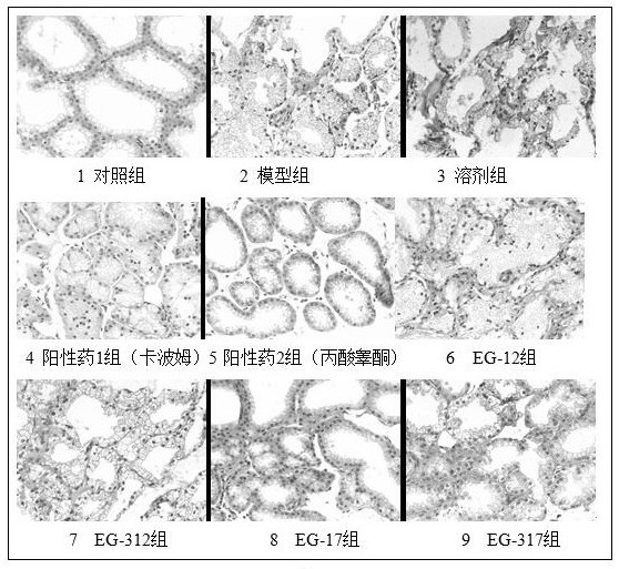 Application of ester-containing aromatic propionamide compound in preparation of medicine for treating xerophthalmia