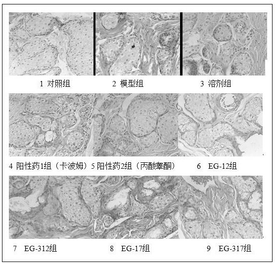 Application of ester-containing aromatic propionamide compound in preparation of medicine for treating xerophthalmia