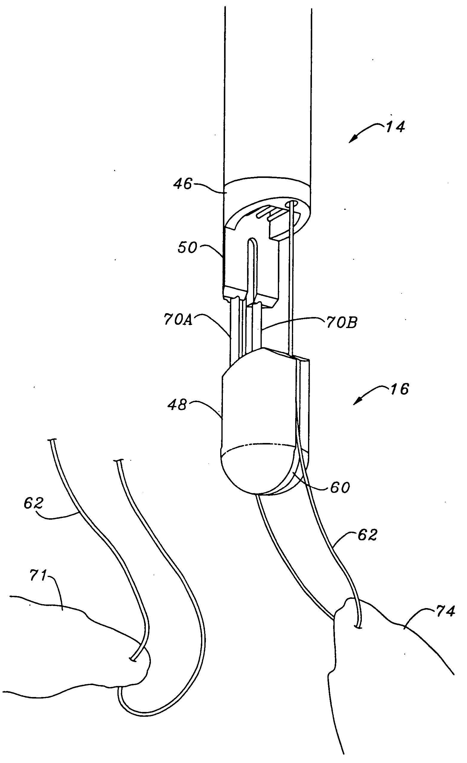 Single catheter mitral valve repair device and method for use