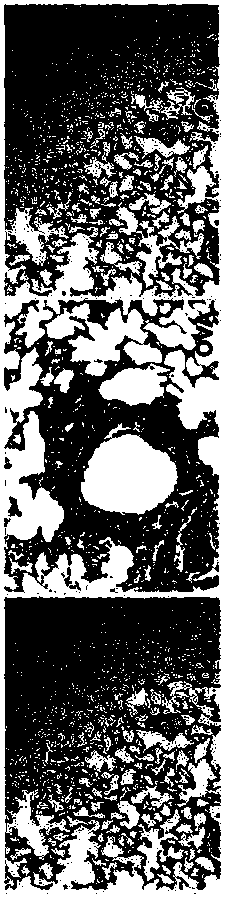 Complex probiotic for treating and preventing allergic diseases as well as preparation method and preparation of complex probiotic