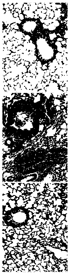 Complex probiotic for treating and preventing allergic diseases as well as preparation method and preparation of complex probiotic