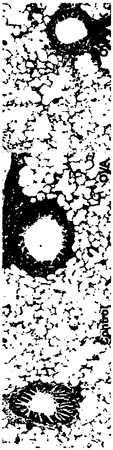 Complex probiotic for treating and preventing allergic diseases as well as preparation method and preparation of complex probiotic