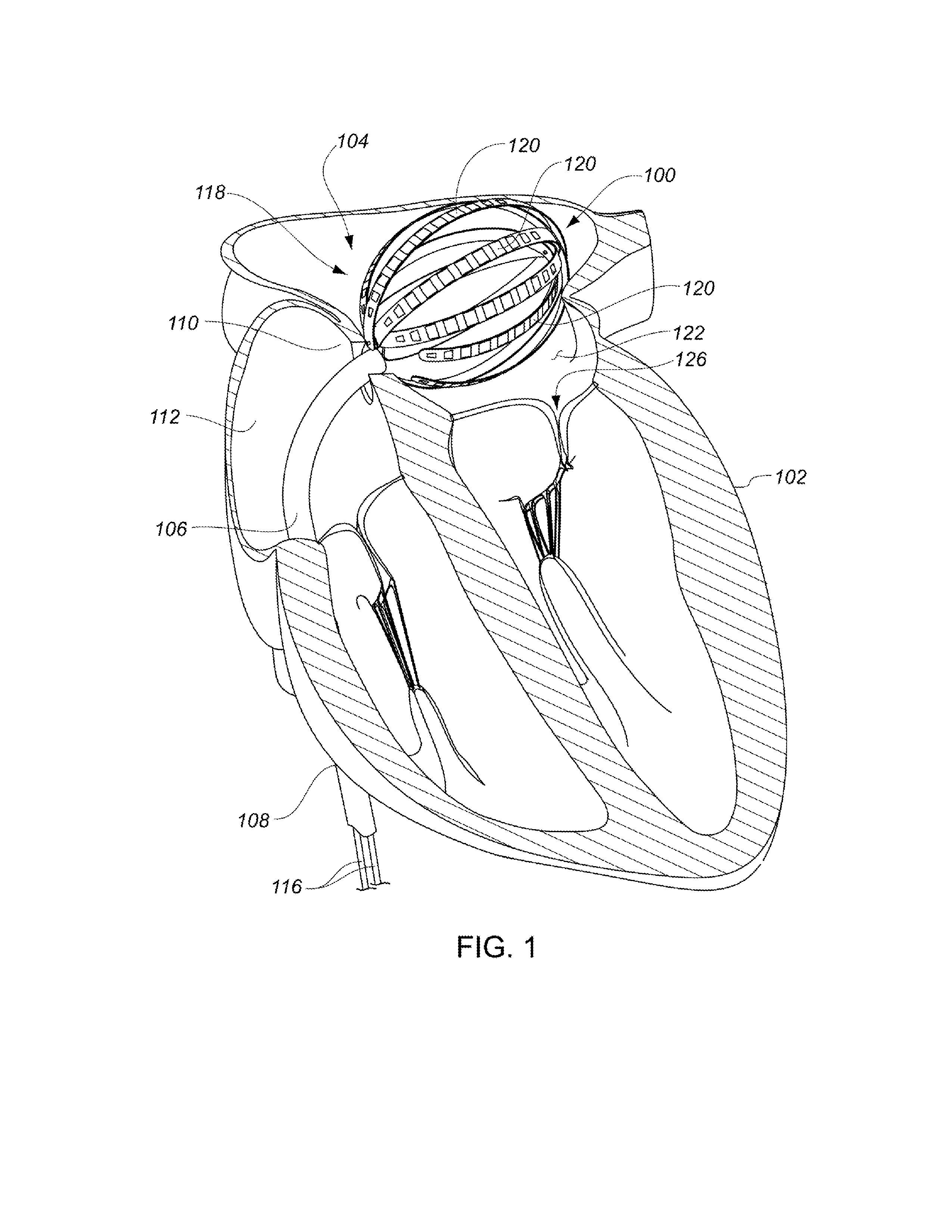 Enhanced medical device for use in bodily cavities, for example an atrium