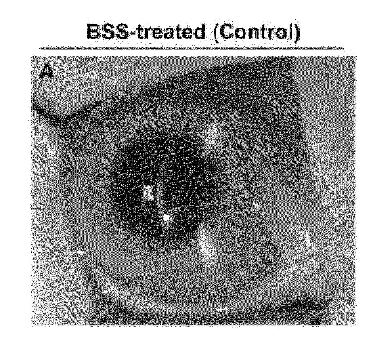 Method of Tissue-Selective Targeted Gene Transfer