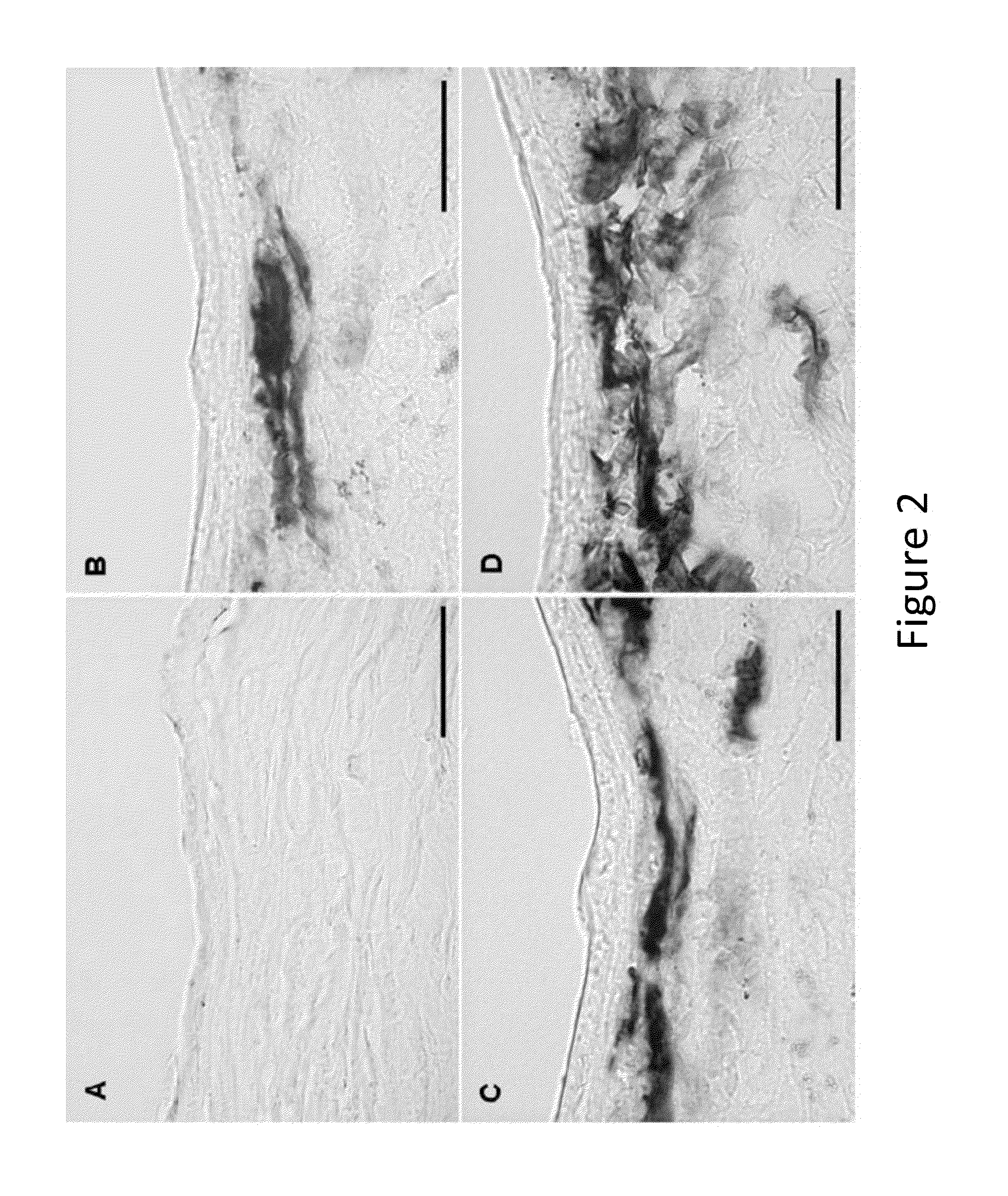 Method of Tissue-Selective Targeted Gene Transfer