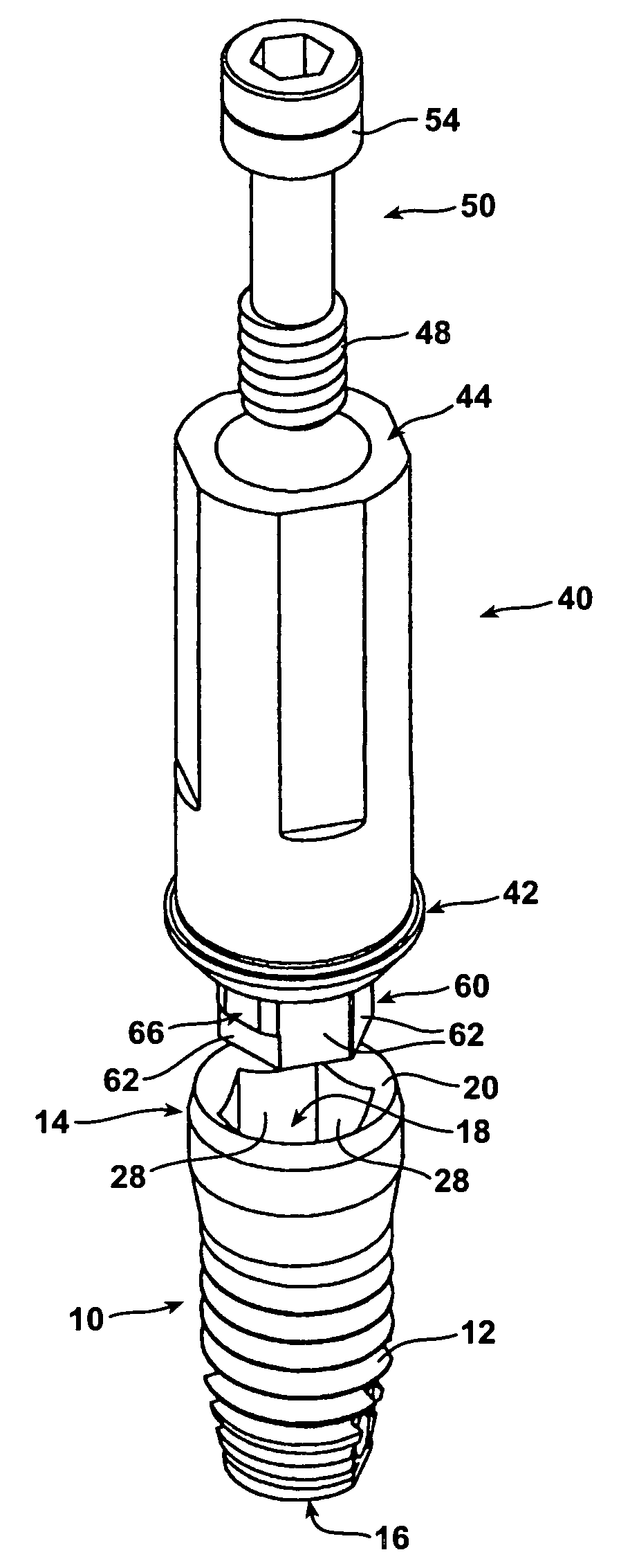 Rotationally immobilized dental implant and abutment system