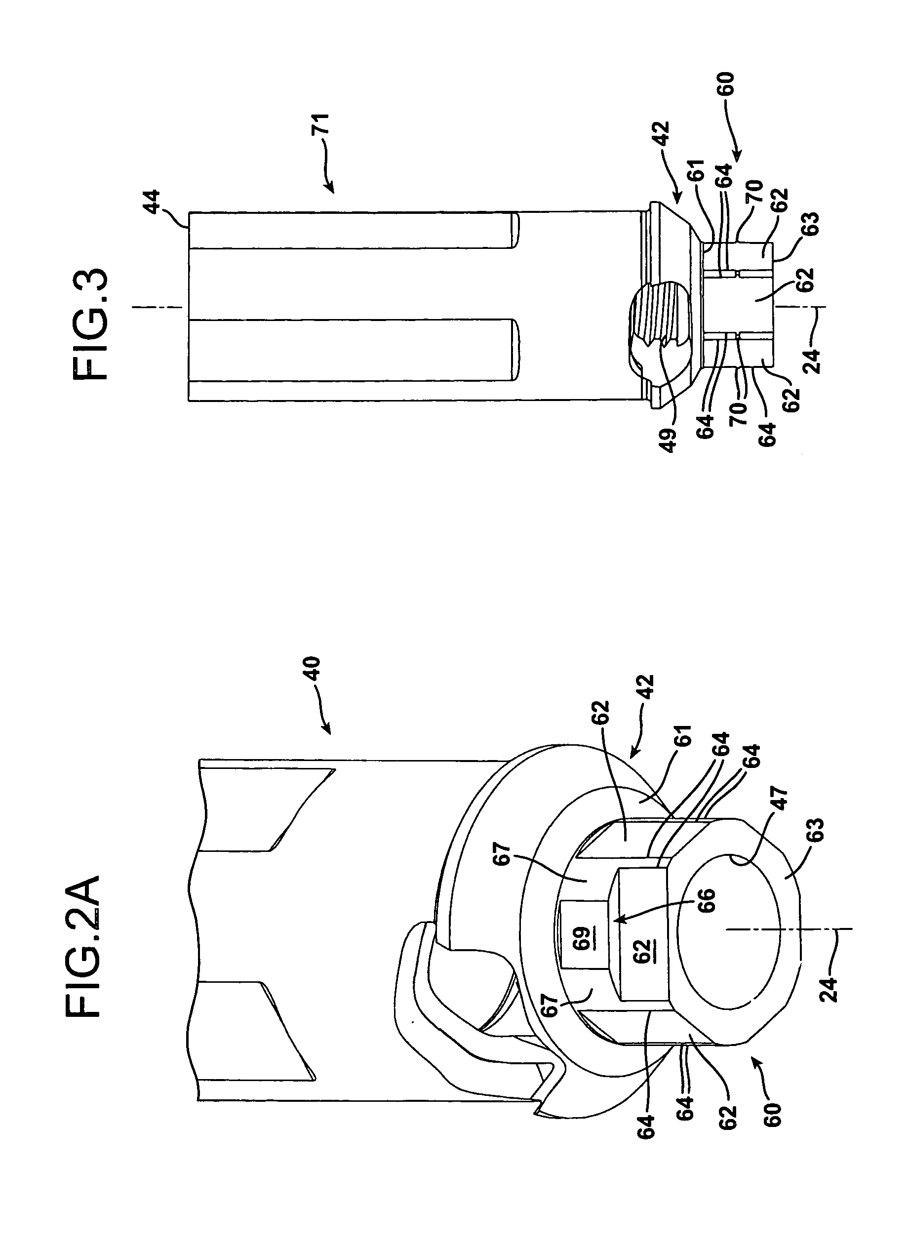 Rotationally immobilized dental implant and abutment system