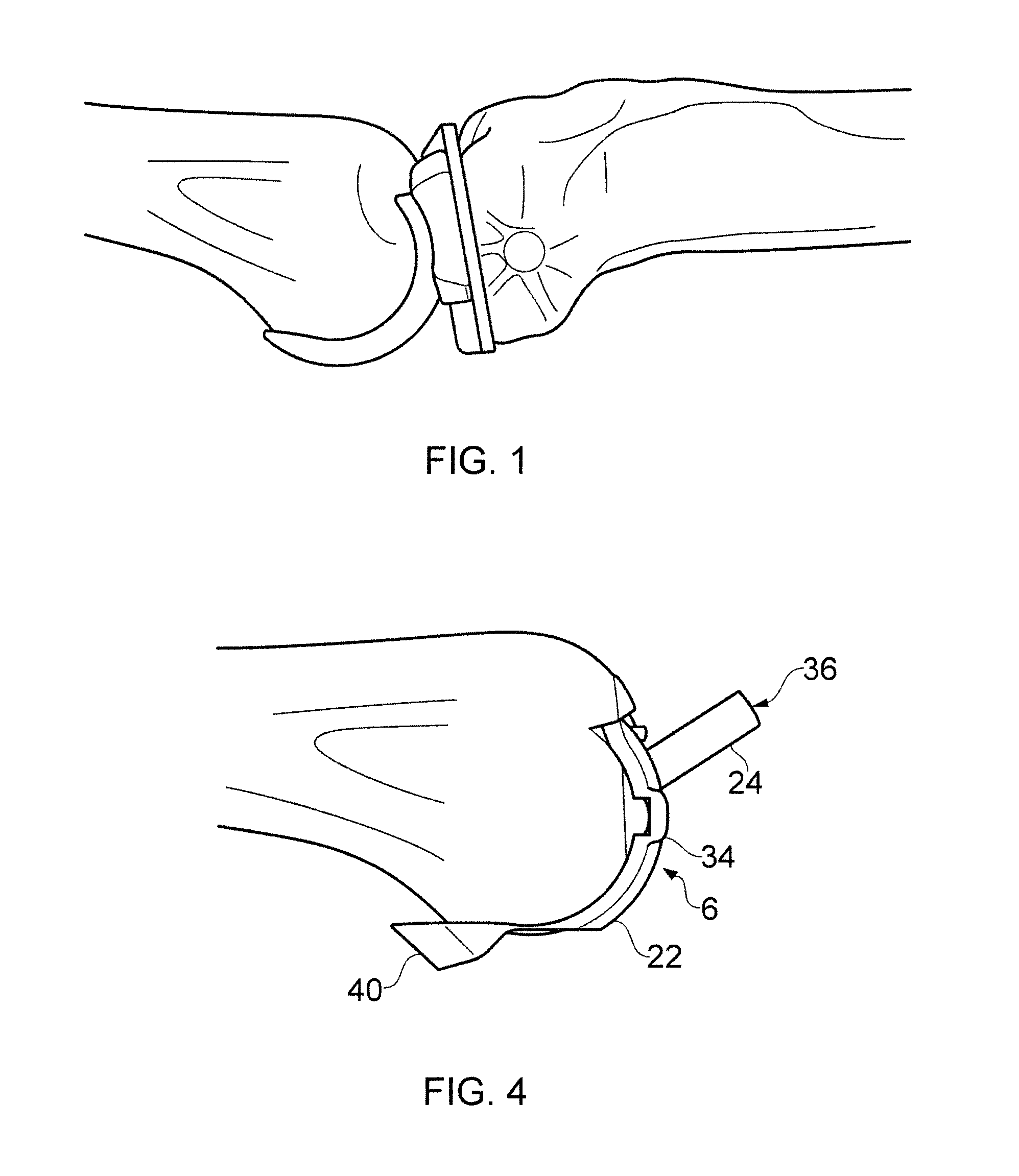 Rotary mill