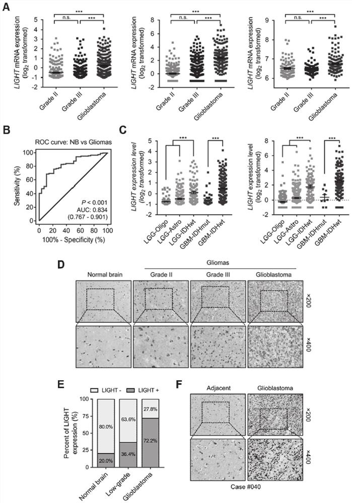 Application of LIGHT to diagnosis and treatment of glioma